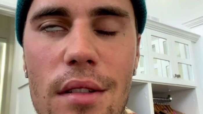 Justin bieber health