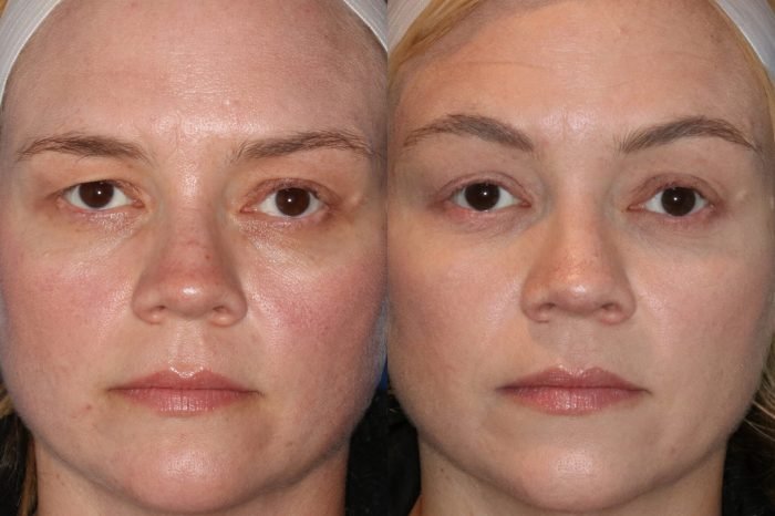 Eye health northwest