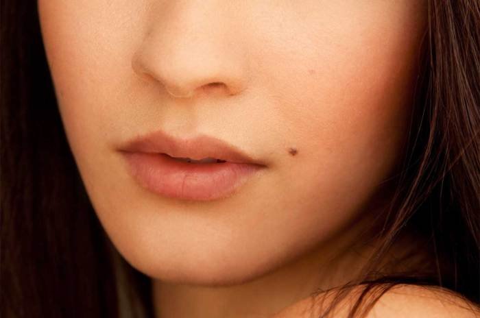 Beauty marked