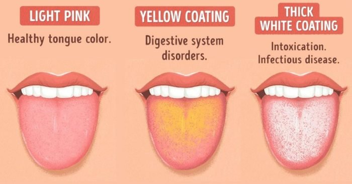 Tongue tcm clinic